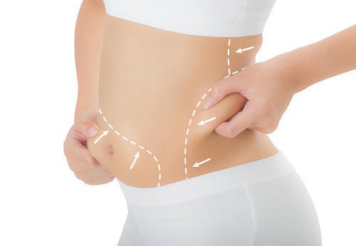 Liposuction surgery in India has the highest medical grade and surgical equipment. Check out the top liposuction surgery in India reviews.